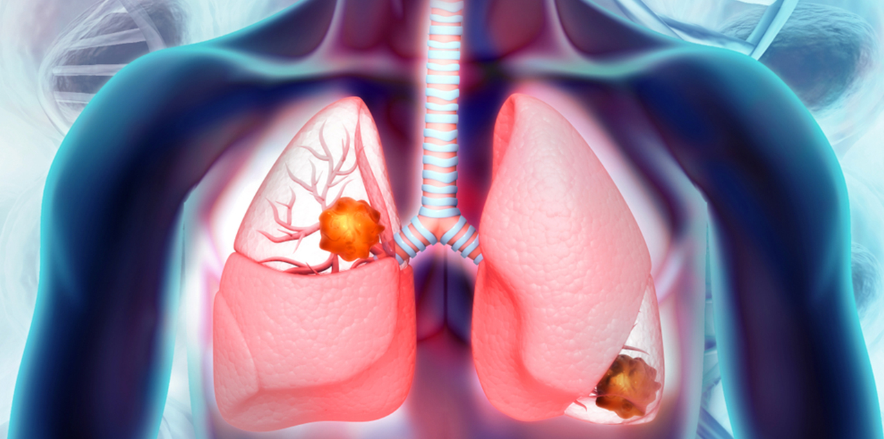 Building Better Lungs: How to Keep Them Healthy